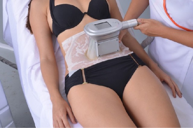 Foto 1 - Criolipse - lipo sem corte 15% de desconto